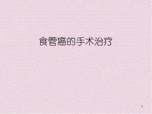 食管癌术式医学PPT课件.ppt