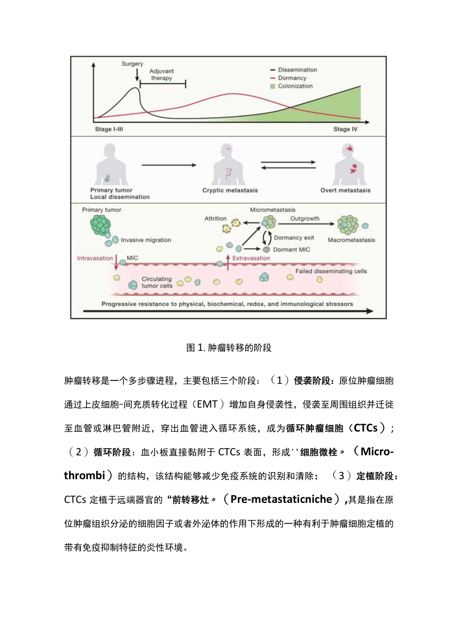 2023肿瘤转移的主要机制及治疗（全文）.docx_第2页