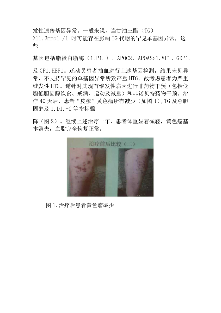 心内科医师晋升副主任（主任）医师高级职称病例分析专题报告（继发性高甘油三酯血症病例）.docx_第3页