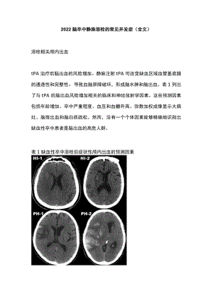2022脑卒中静脉溶栓的常见并发症（全文）.docx
