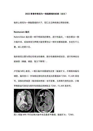 2022影像学表现为一侧脑萎缩的疾病（全文）.docx