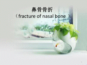 鼻骨骨折医学PPT课件.pptx
