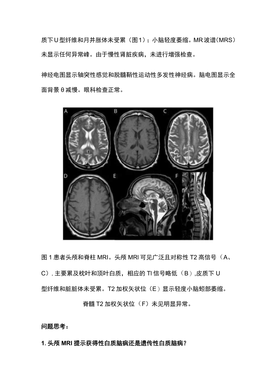 轻患者出现亚急性痉挛性截瘫(全文).docx_第2页
