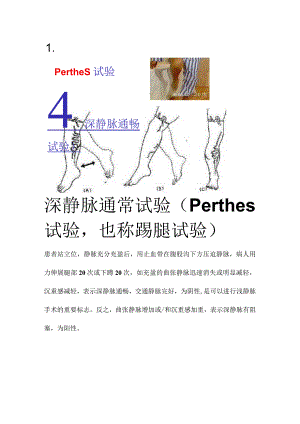 深静脉通常试验（Perthes试验也称踢腿试验）.docx