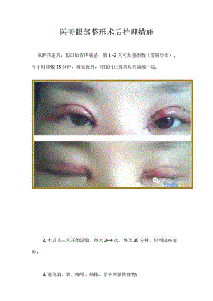医美眼整形术后8项护理措施.docx