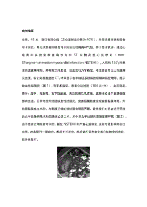 2023缺血性结肠炎的诊断和治疗.docx