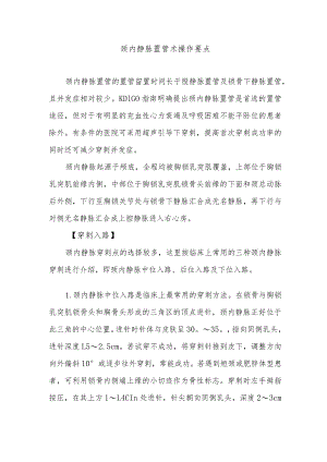 颈内静脉置管术操作要点.docx