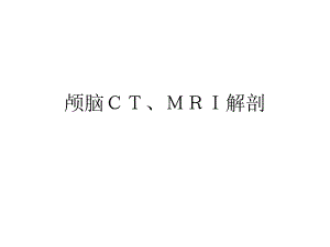 颅脑CTMRI解剖3.ppt