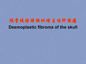 骨瘤王振宁.ppt