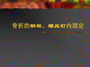 骨折的内固定.ppt