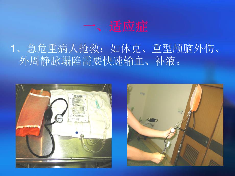 锁骨下静脉穿刺术欧智颖.ppt_第2页