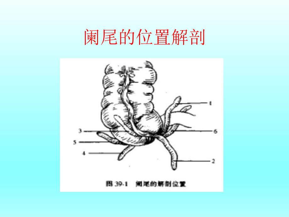 阑尾炎诊断治疗手术课件全.ppt_第3页