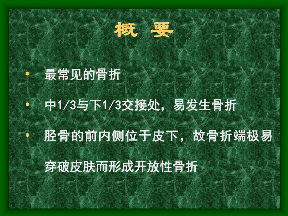胫腓骨骨折课件.ppt_第2页