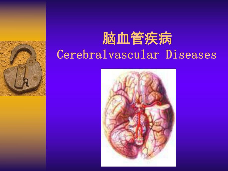 脑血管疾病医学概论.ppt_第1页