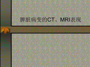 脾病变的MRI表现.ppt