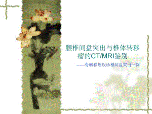 腰椎转移瘤误诊.ppt