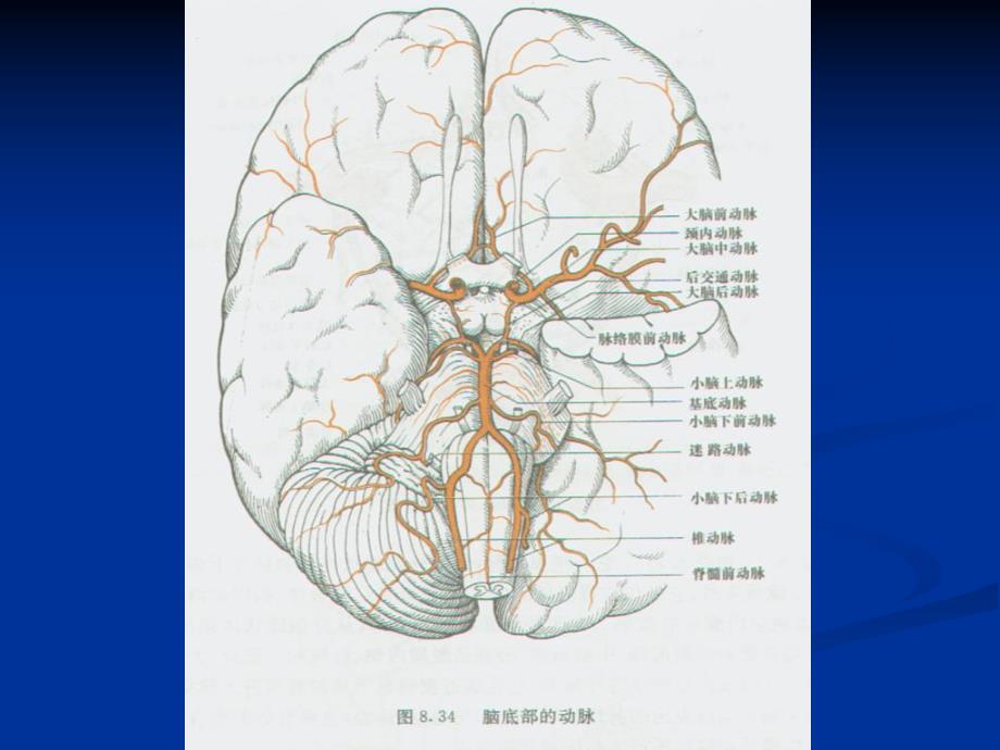脑血管疾病06071.ppt_第3页