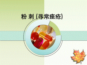 粉刺课件.ppt