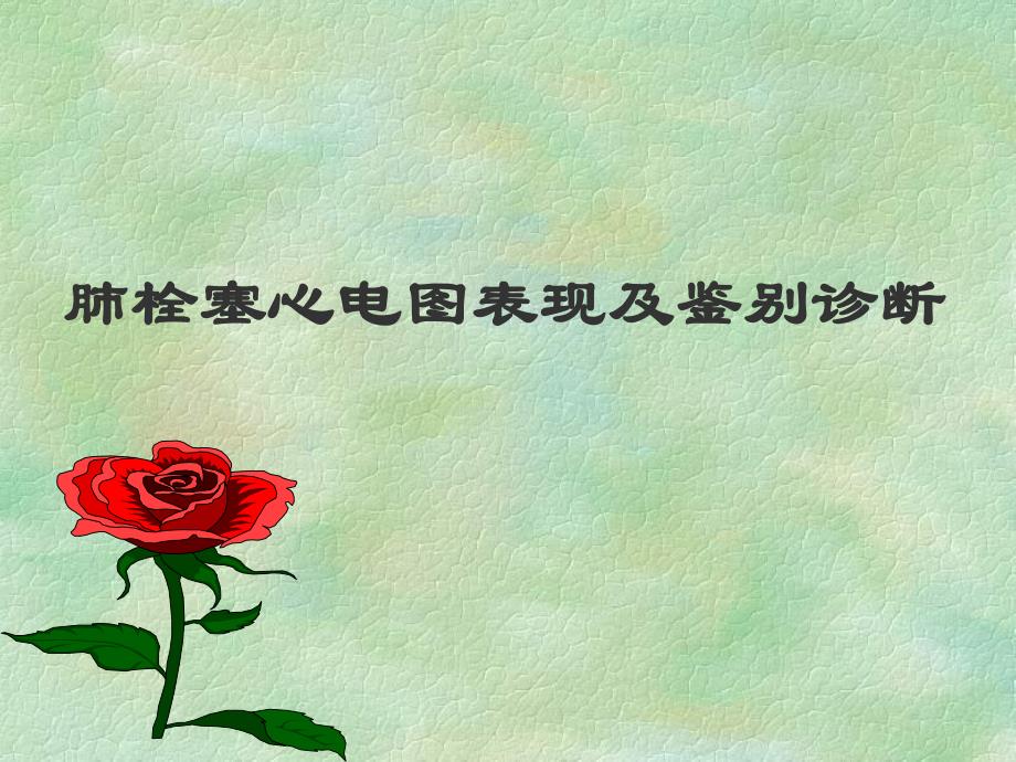 肺栓塞心电图.ppt_第1页