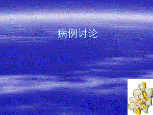 腰椎滑脱修改.ppt