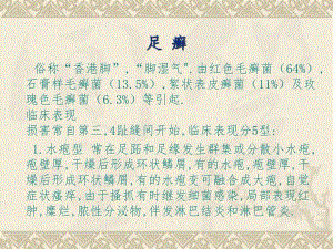 足癣体廯等皮肤病.ppt