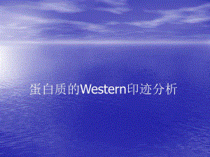 蛋白质的Wesrern印迹分析.ppt