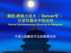 腹腔静脉分流术在难治性腹水中的应用.ppt