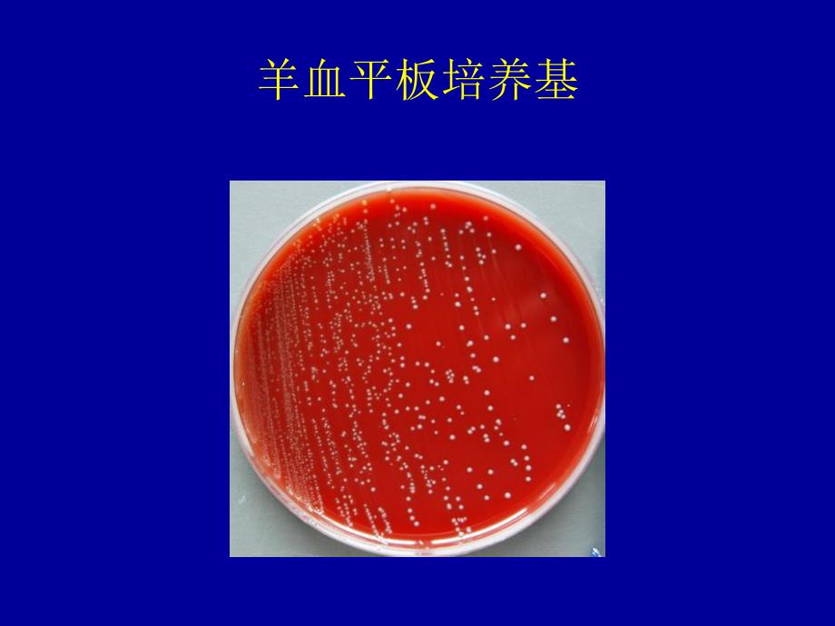 蛋白质样品的制备25.ppt_第3页