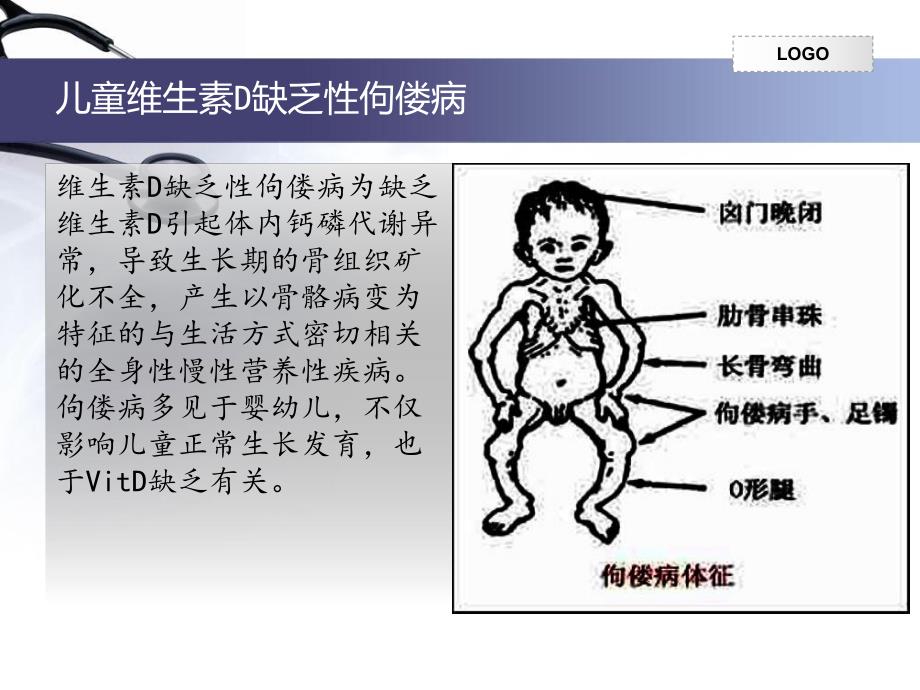 营养性疾病的防治.ppt_第2页