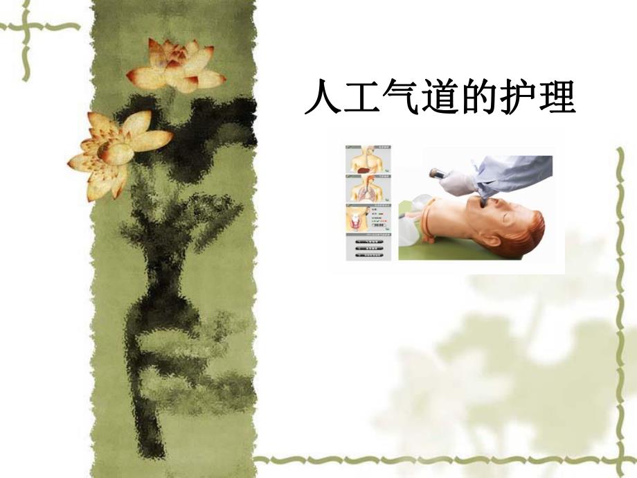 大外科人工气道的护理.ppt_第1页