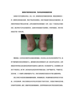 困惑孩子是否有后足外翻-可去专业机构检查配矫正鞋.docx