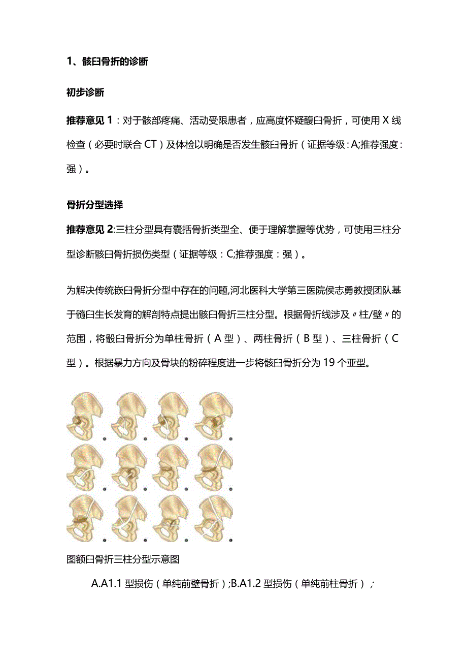 2023基于三柱分型的髋臼骨折精准诊疗专家共识.docx_第2页