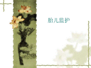 胎儿监护图像.ppt