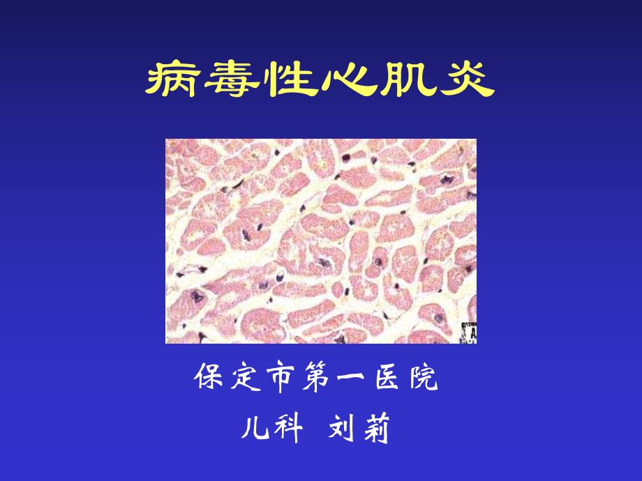 病毒性心肌炎.ppt.ppt_第1页