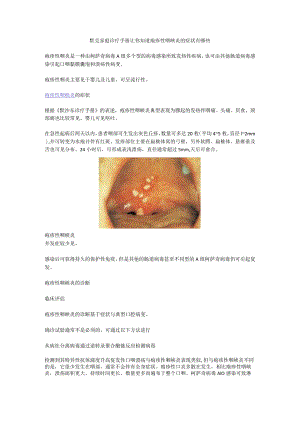 默克家庭诊疗手册让你知道疱疹性咽峡炎的症状有哪些.docx
