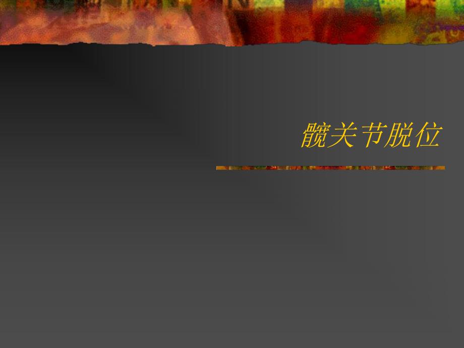 【精品PPT】髋关节脱位.ppt_第1页