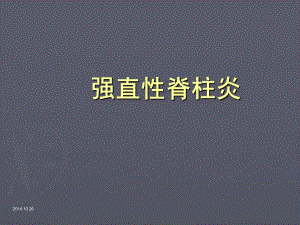 【医学课件】强直性脊柱炎.ppt