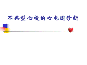 【精品PPT】下载 不典型心梗的心电图诊断.ppt