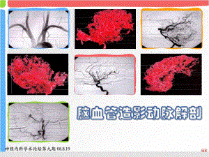 [医学]脑血管造影动脉解剖读书报告.ppt