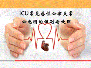 ICU常见恶性心律失常心电图的识别与处理.ppt