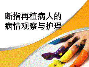 5月断指再植病人的病情观察与护理.ppt