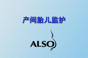 产中胎儿监护.ppt
