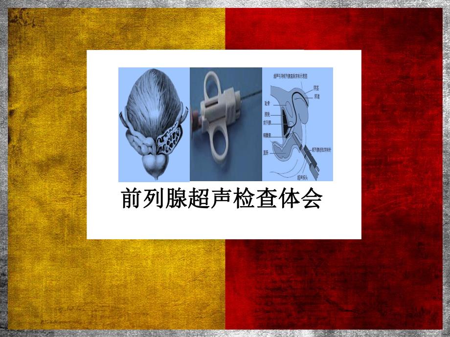 前列腺检查体会.ppt_第1页