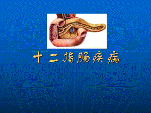 十二指肠疾病.ppt