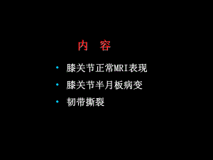 半月板和韧带核磁共振诊断2.ppt