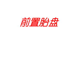 前置胎盘[精彩].ppt