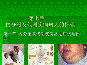 内分泌及代谢疾病常见症状与体征PPT演示文稿.ppt