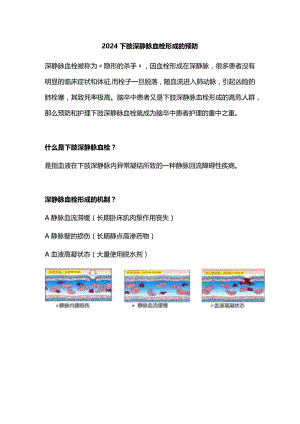2024下肢深静脉血栓形成的预防.docx