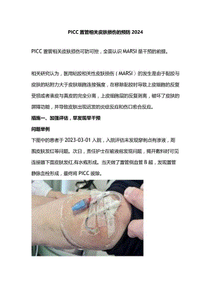 PICC置管相关皮肤损伤的预防2024.docx