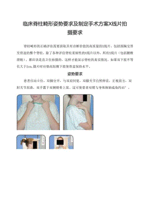临床脊柱畸形姿势要求及制定手术方案X线片拍摄要求.docx